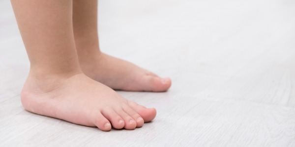 Pie plano en niños