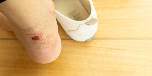 Ampollas en los pies niños