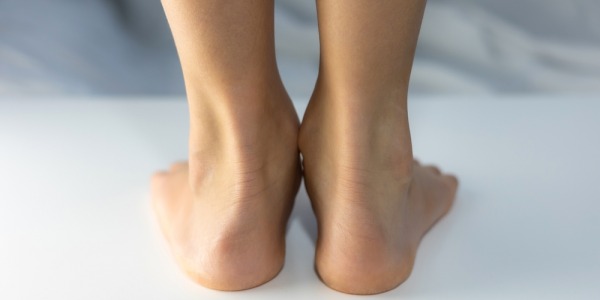 Qué es la pisada supinadora y como tratarla