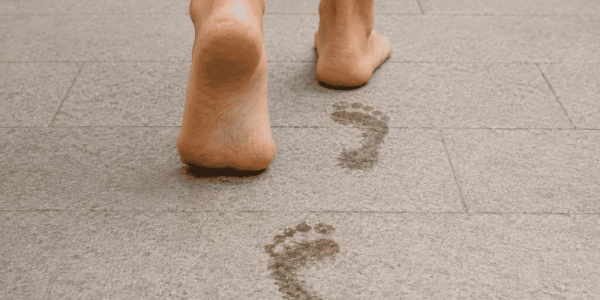 Pisada pronadora supinadora: diferencias, causas y cómo elegir el calzado adecuado