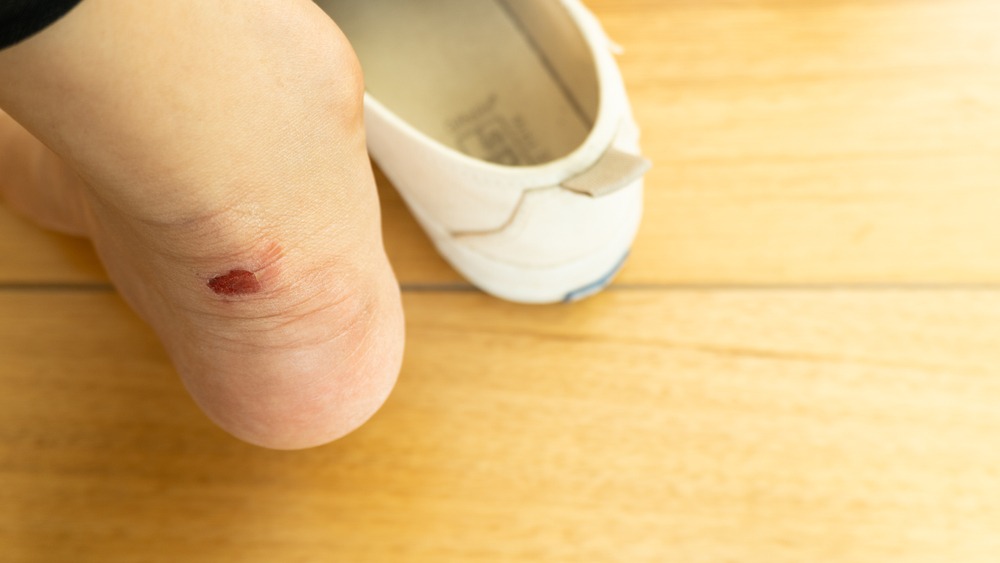 Ampollas en los pies niños